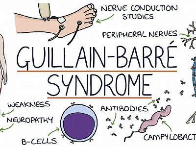 Клинический случай синдрома Барде-Бидля, диагностированного у взрослого